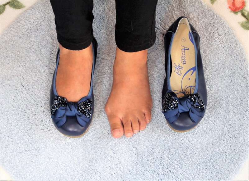 姆指外翻美鞋-柔软舒压/皇家蓝钻 - 其他女款皮鞋 - 真皮 蓝色