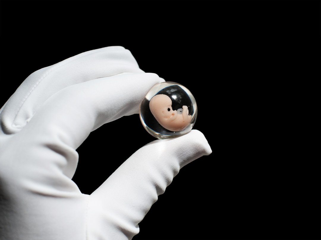Embryo 7 weeks in Lens, 7 weeks pregnant, Sculpture cast in resin. With Yolk Sac - 玩偶/公仔 - 树脂 
