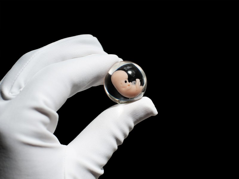 Embryo 7 weeks in Lens, 7 weeks pregnant, Sculpture cast in resin. With Yolk Sac - 玩偶/公仔 - 树脂 