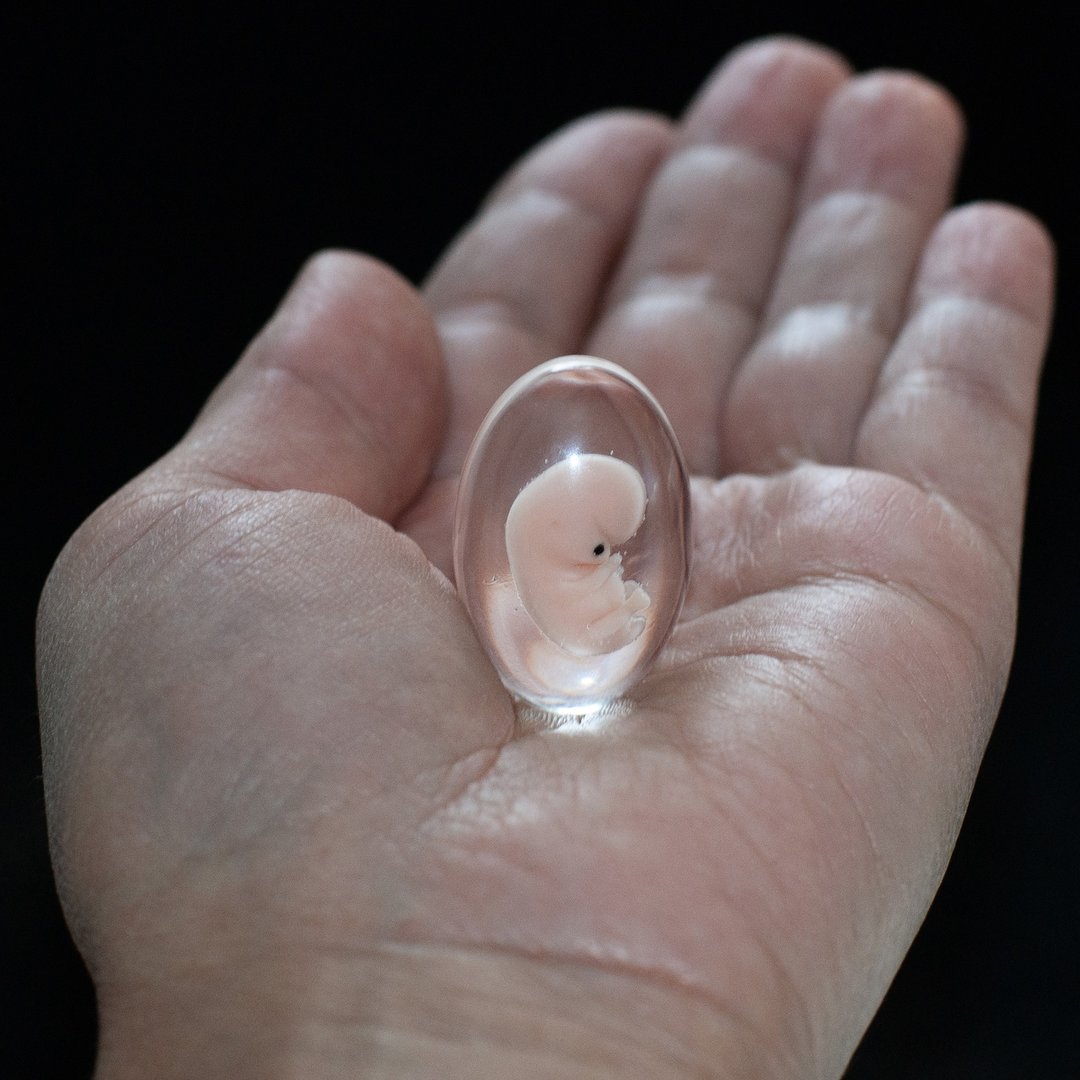 Embryo 7 weeks in Oval Lens, 7 weeks pregnant, Sculpture cast in resin. - 玩偶/公仔 - 树脂 