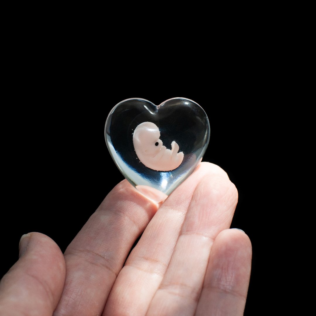 Embryo 7 weeks, 7 weeks pregnant, Sculpture cast in resin - 玩偶/公仔 - 树脂 