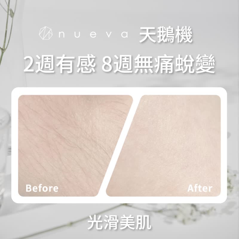 Swan 天鹅Pro除毛嫩肤仪-超值两入 - 脸部清洁/卸妆用品 - 其他材质 